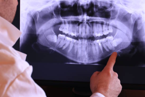 Best Pediatric Emergency Dentist in Elliston, VA