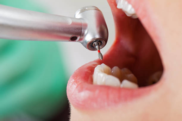 Best Mobile Emergency Dentist in Elliston, VA